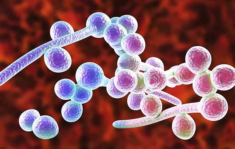 10 cách phòng ngừa nhiễm trùng nấm men